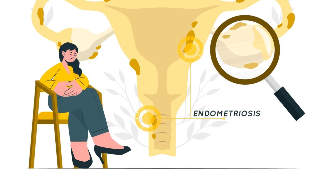 La Endometriosis y la Violencia Obstétrica