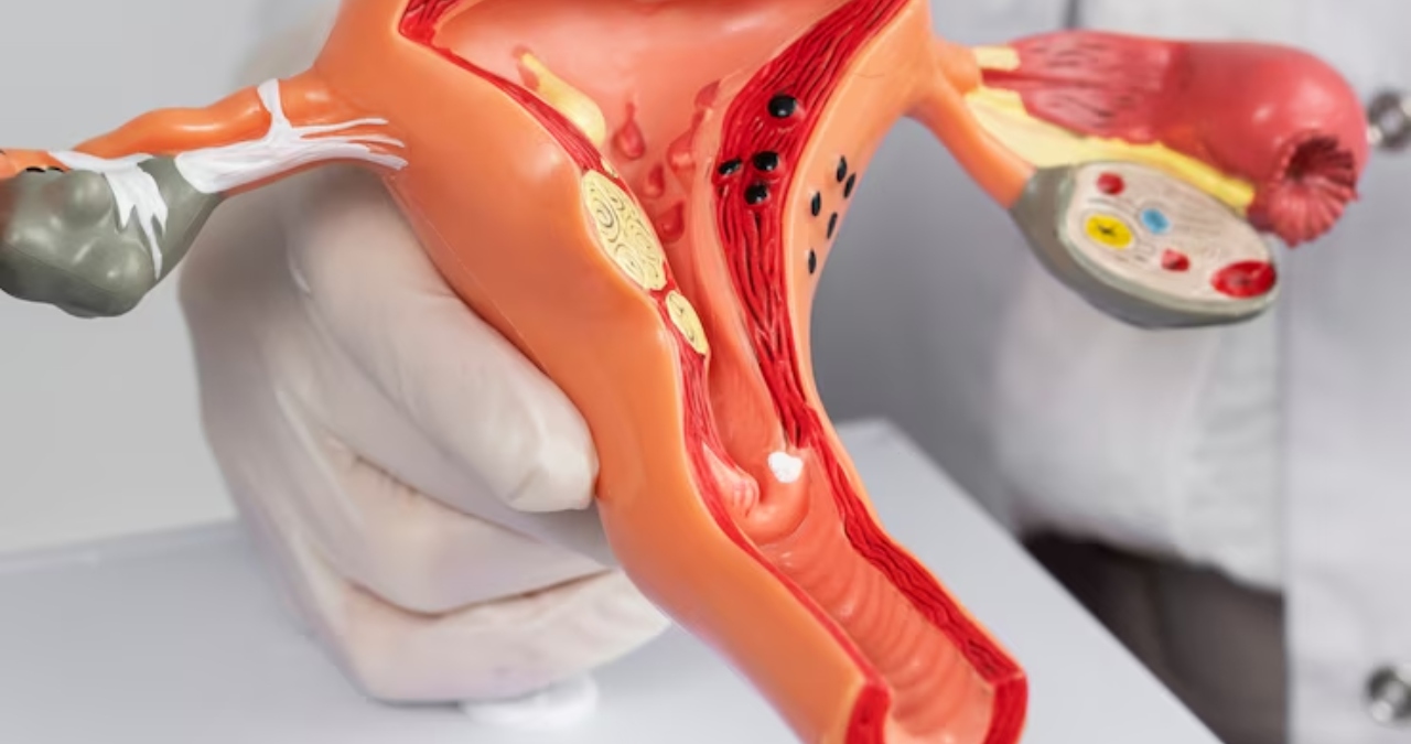 Endometriosis, Menopausia y Menstruación: ¿por qué sigue siendo tabú hablar salud reproductiva femenina?
